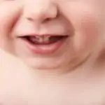 baby's first teeth